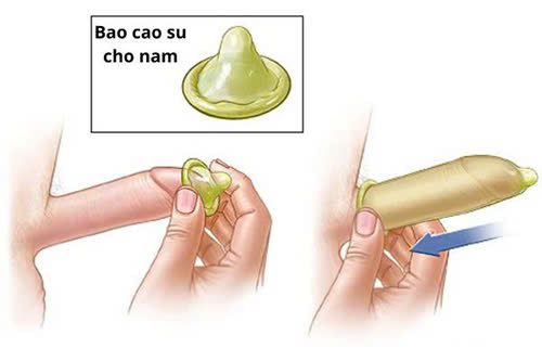 Hình dạng và cơ chế bảo vệ của bao cao su dành cho nam giới